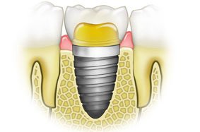 Perfectdent - clinica stomatologie